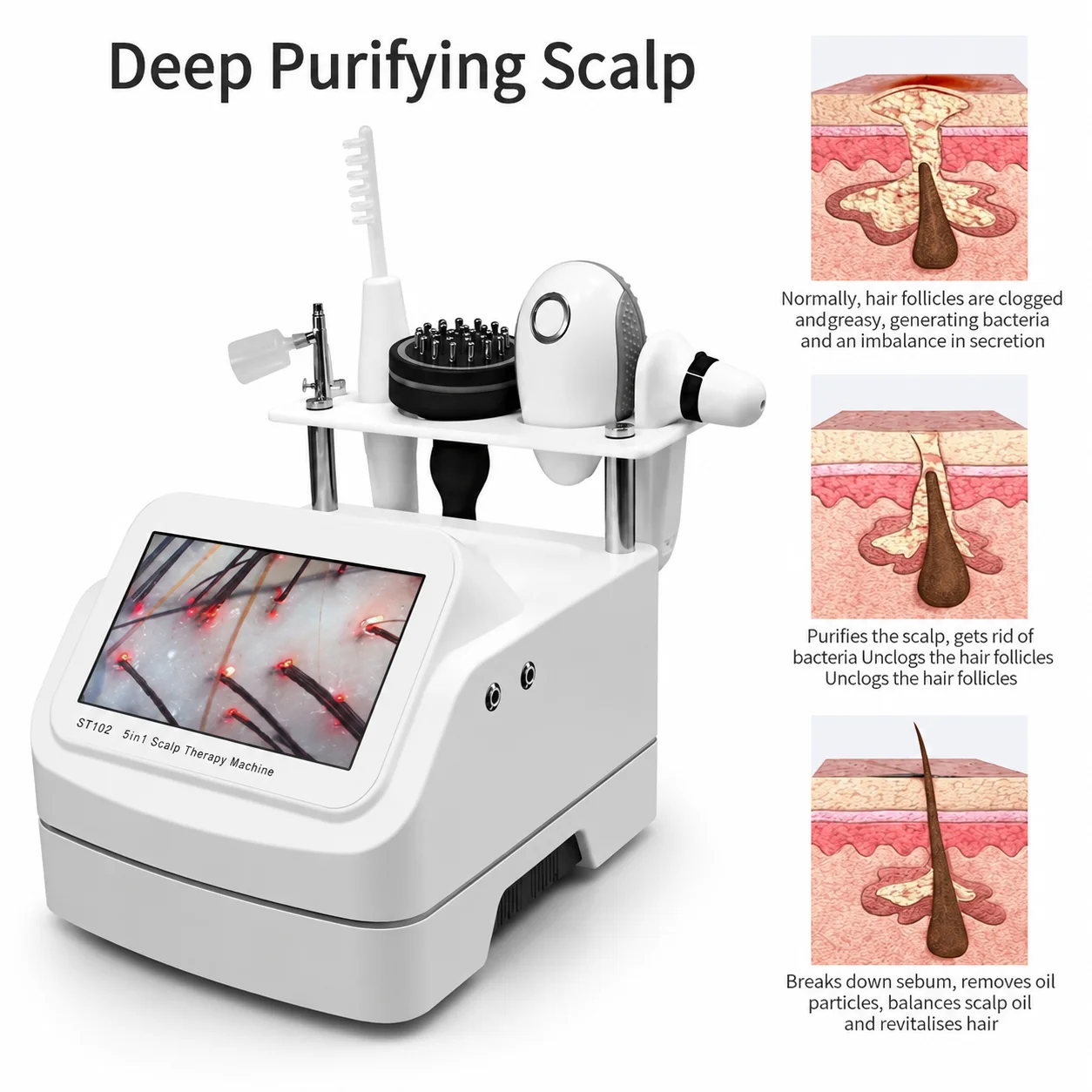 5-in-1 Multi-Function Scalp Care Device, Scalp Analyzer, Hair Care Machine, Anti-Hair Loss Beauty Salon