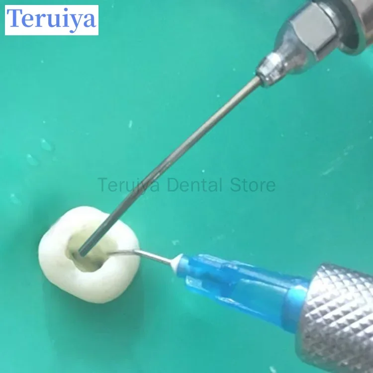 Premium Medical-Grade Dental Threaded Suction Tip