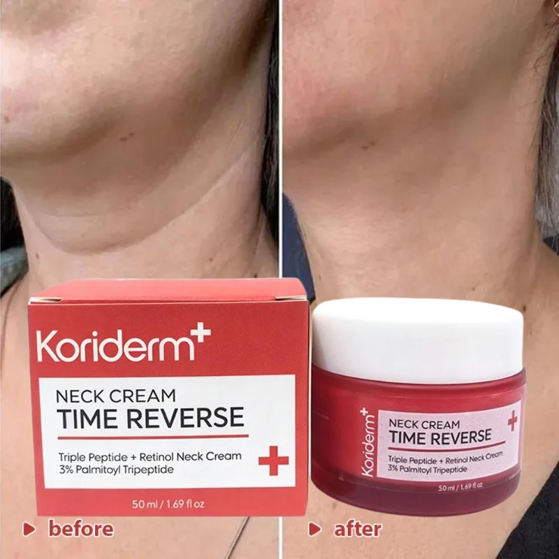 Koriderm+ Time Reversal Neck Tightening Cream Tripeptide Retinol Smooth Double Chin Eliminate Neck Wrinkles Skin Care Cream