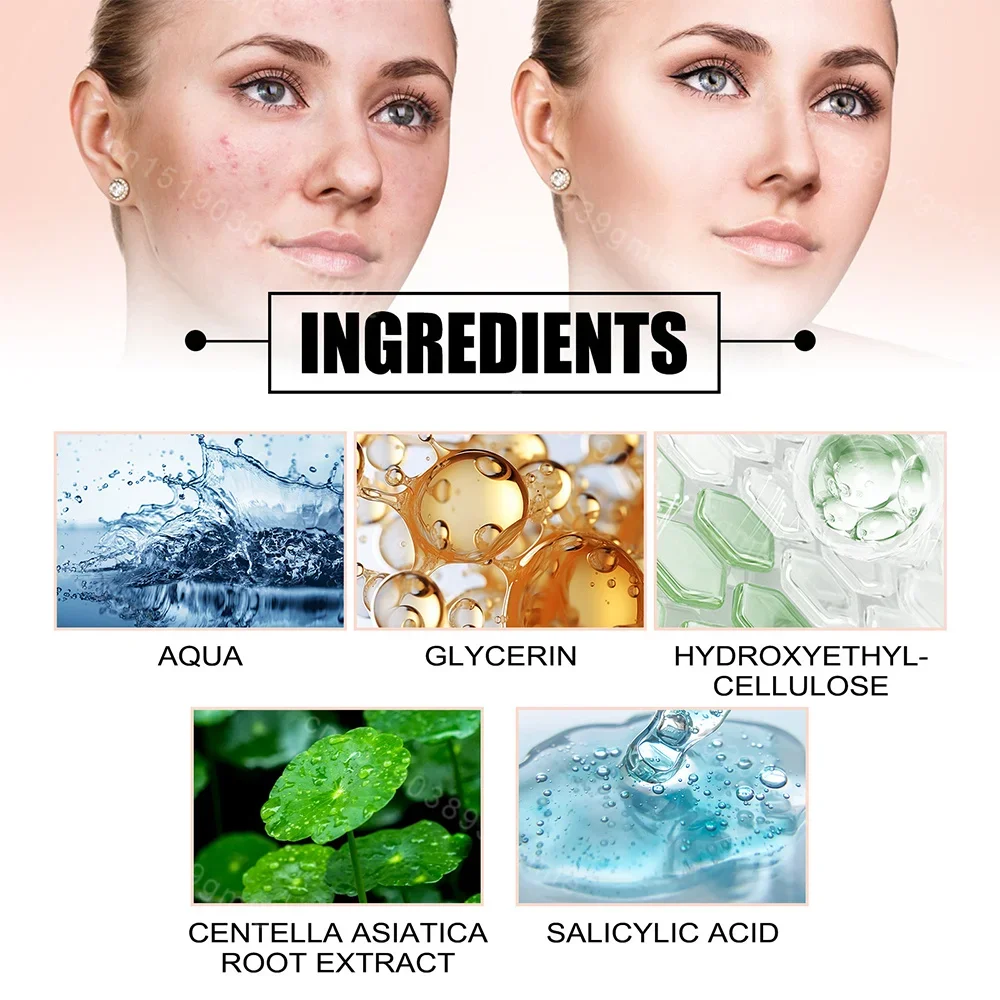 Star Acne Patch Dissolvenza Riparazione Adesivi invisibili per la rimozione dell'acne Simpatico correttore Strumento per il trucco Stile stella con scatola di immagazzinaggio a specchio