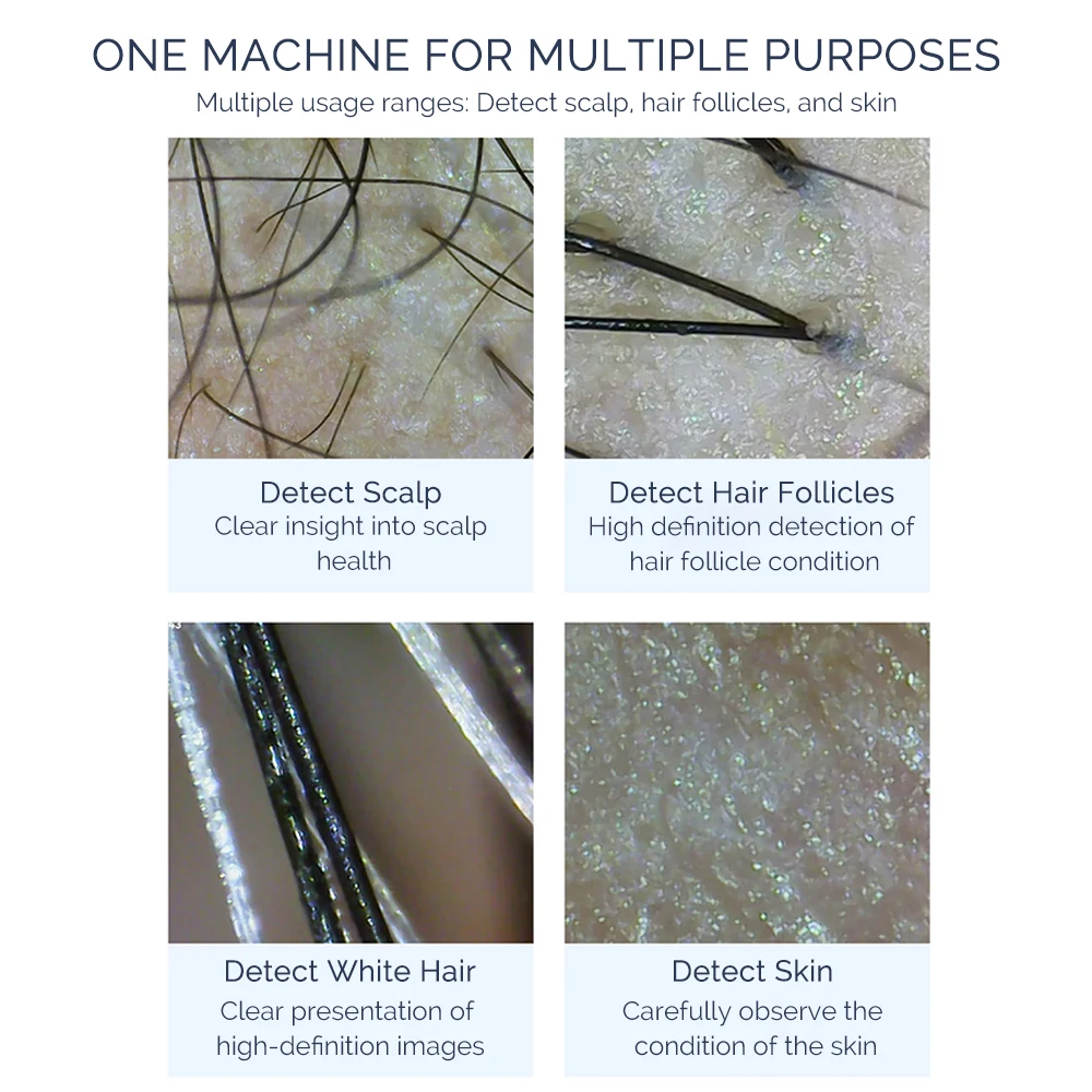 50X/200X HD Hair Analyzer Home Use Scalp Hair Follicle Scanner Detector APP WIFI Digital Skin Analyzer Microscope Tool