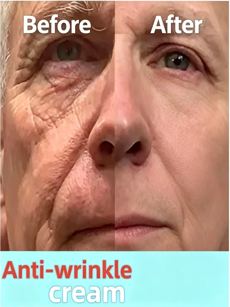 

Retinol Collagen Cream, anti-wrinkle essence, anti-aging essence, reduces wrinkles, suitable for both men and women.