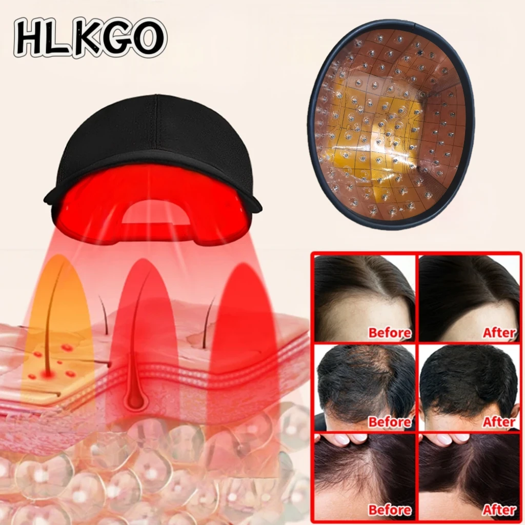 

Smart Hair Growth Laser Hat USB Charging Auto Shut-off 96 Diodes For Effective Hair Loss Control And Regrowth