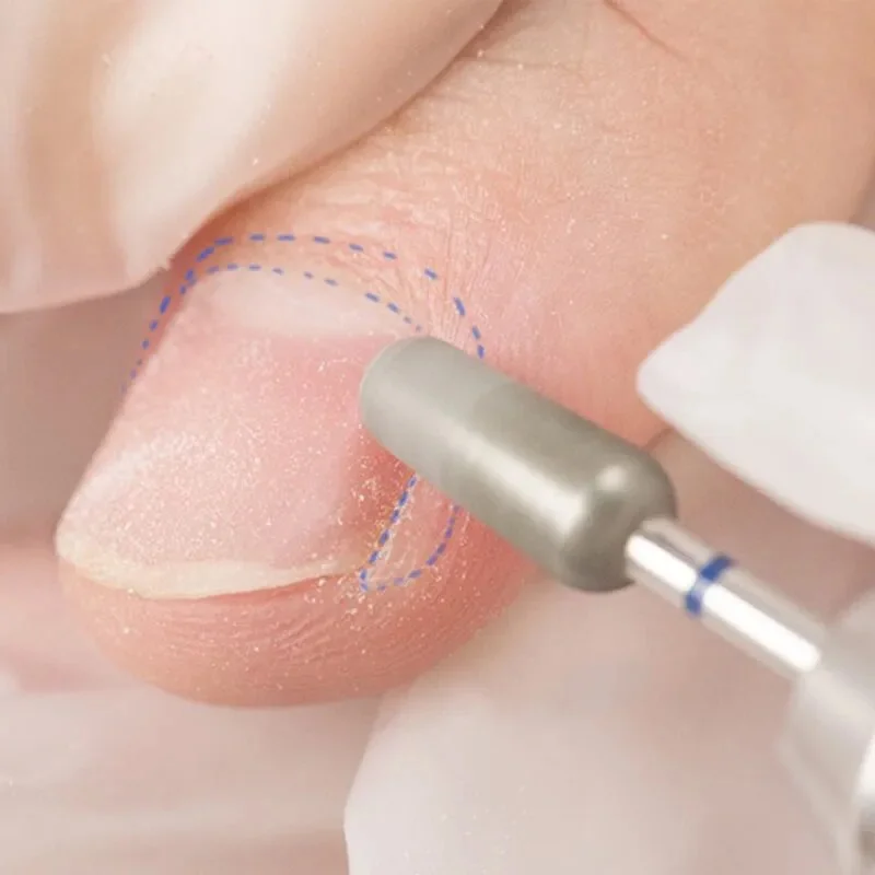 1PC Tornado foret à ongles diamant fraise à ongles pour manucure pédicure cuticule callosités fraise outil électrique perceuse à ongles accessoire