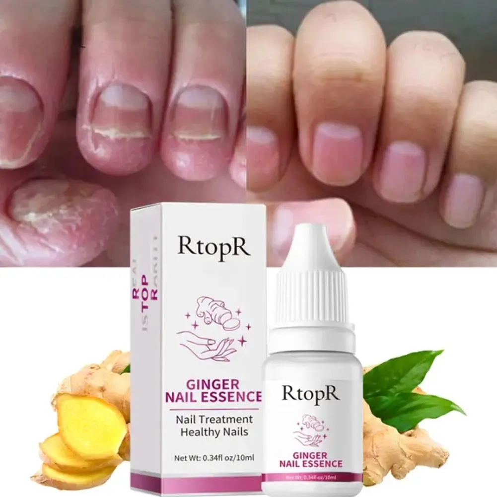 10ml Ginger Nail Care Solution Nourishes Nail Layer Promotes Growth Repair Damaged Layer Rough Broken Painless Nail Health Cream