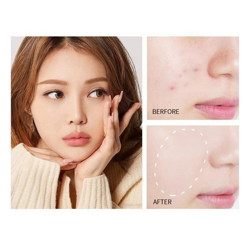 감광성 컨실러, 컨투어링, 하이라이팅, 다크서클, 눈가 주름 개선, 컨투어링 리퀴드 파운데이션 프라이머