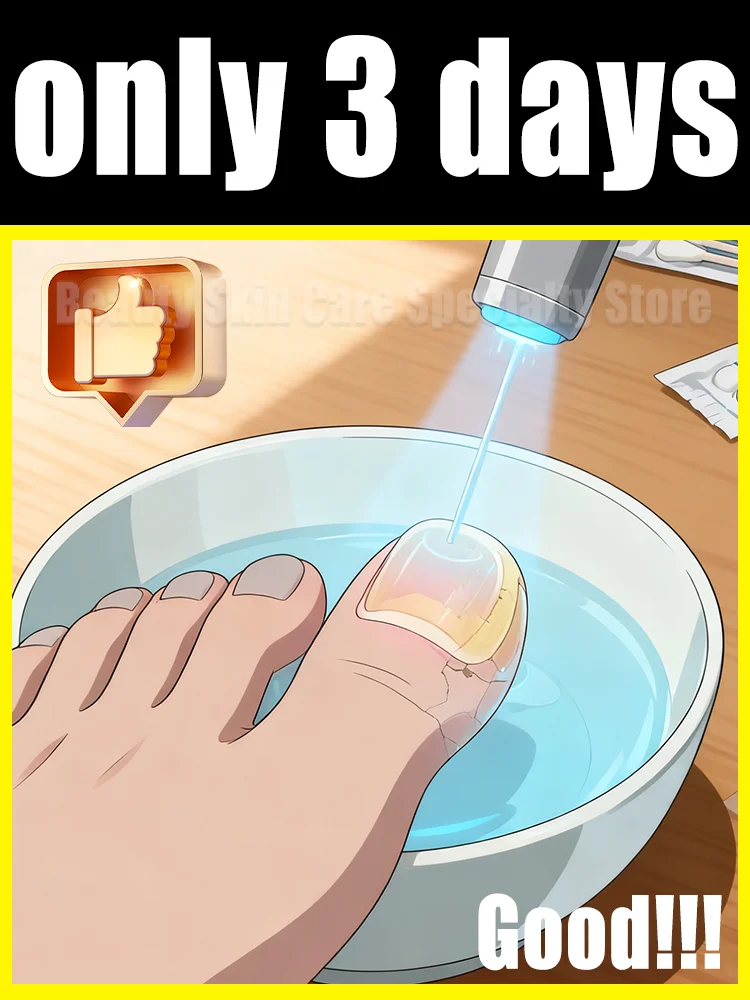 

2025 Hot Sellers: Nail Cleaning Tools, Blue Light Laser Tools Root Repair Upgraded to Second Generation