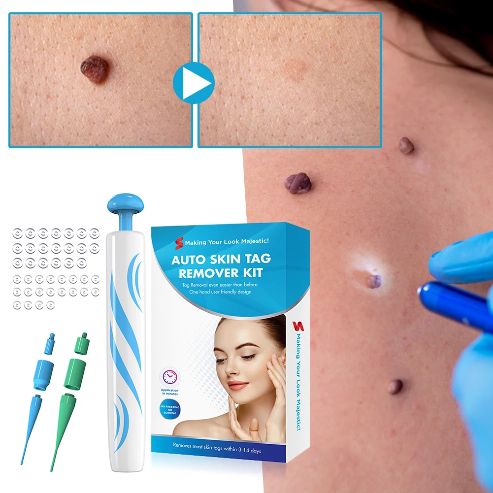 

Набор для удаления бирки на коже 2 в 1, многоцелевой дизайн 2 в 1, инструменты для ухода за кожей