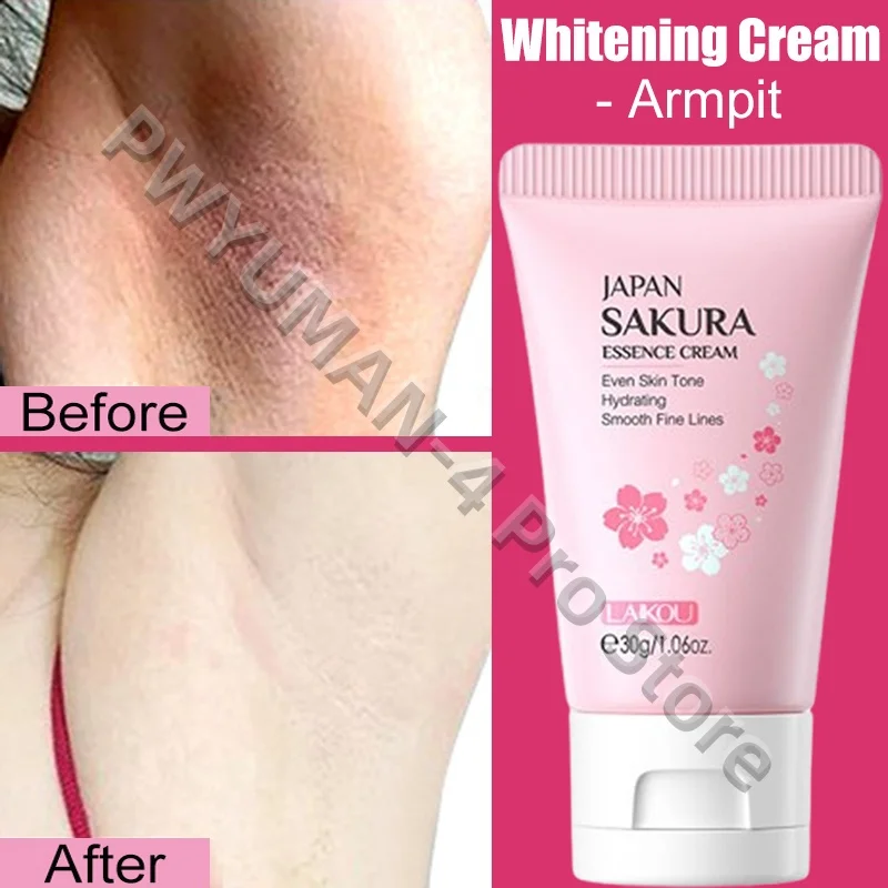 Whitening Cream Private Parts Underarm Bleaching Serum Whiten Butt Knee Brighten Inner Thigh Intimate Parts Dark Remove Melanin