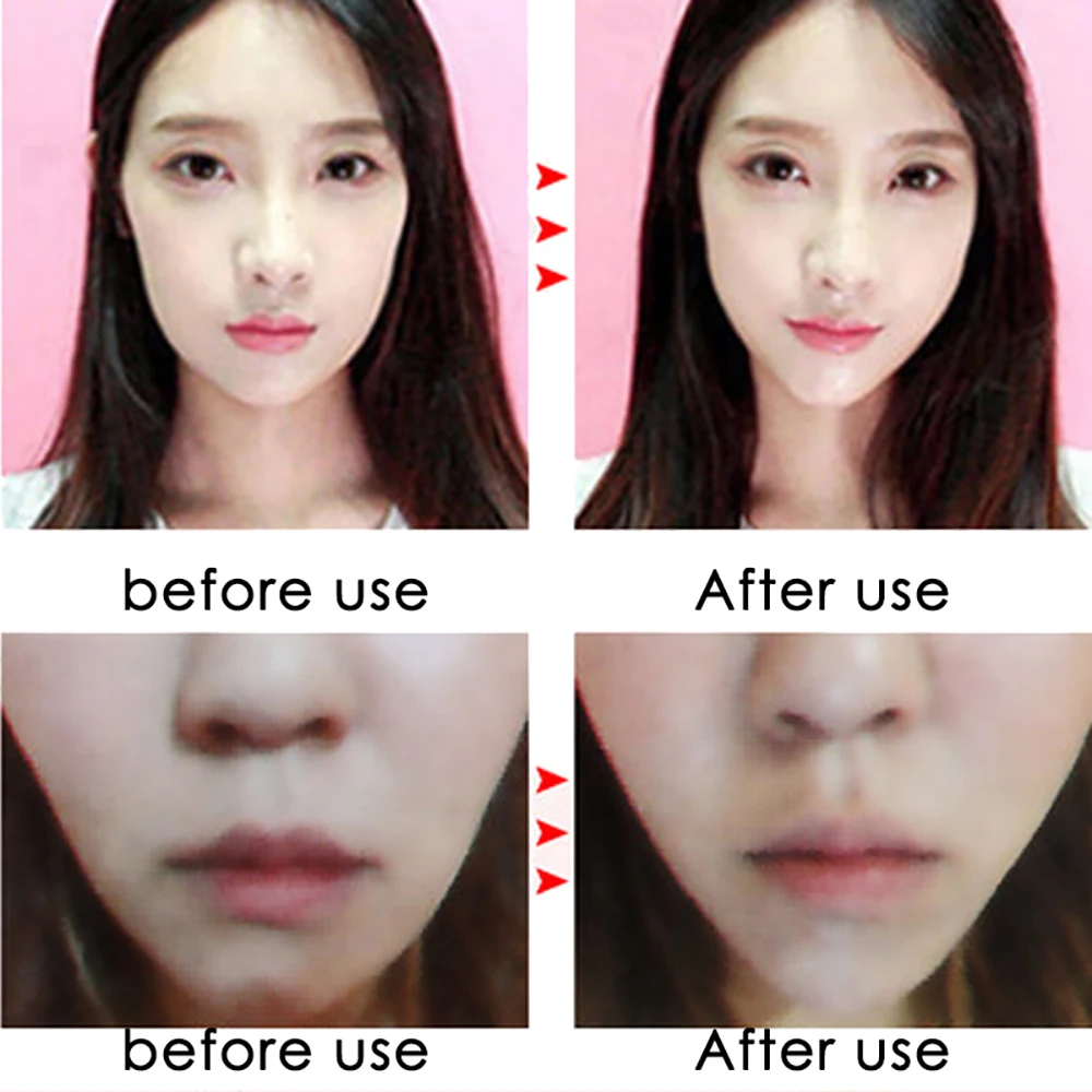 Benda snellente per il viso riutilizzabile, modellatore a V per il viso, cintura per sollevare il mento e le guance, cinturino per massaggio facciale, strumenti di bellezza per la cura della pelle del viso