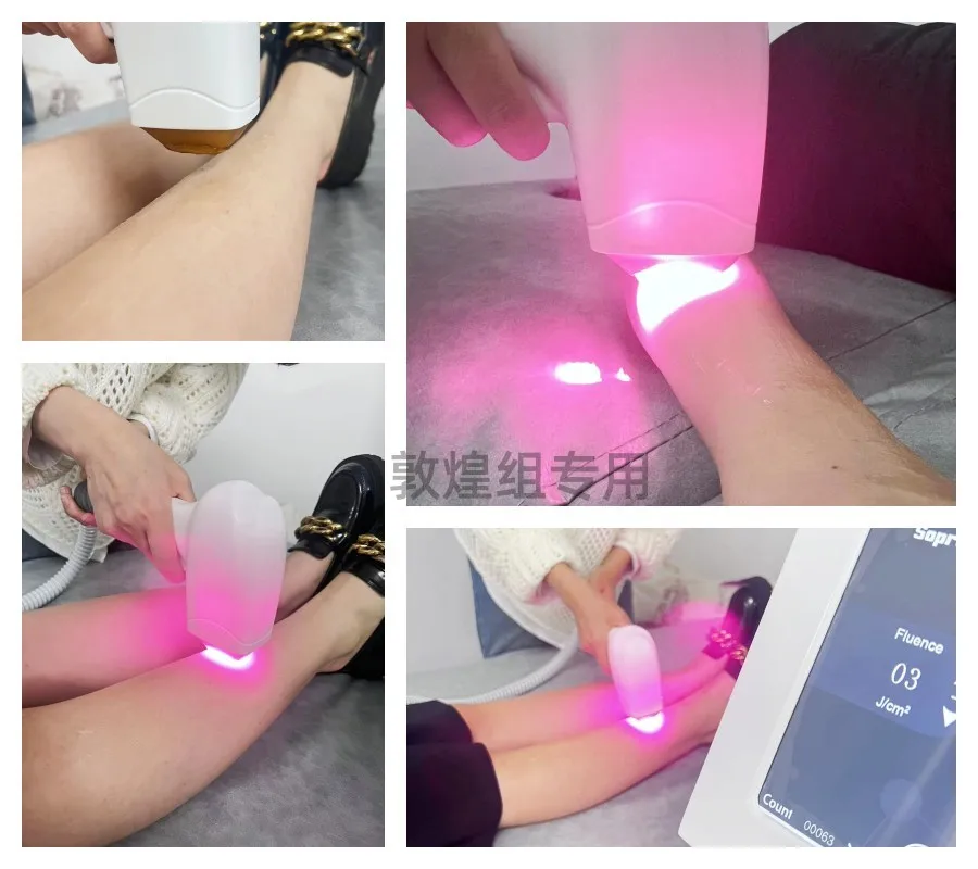 Depiladora con punto de congelación para mujer, máquina de depilación permanente indolora para todos los colores de la piel, novedad de 2024