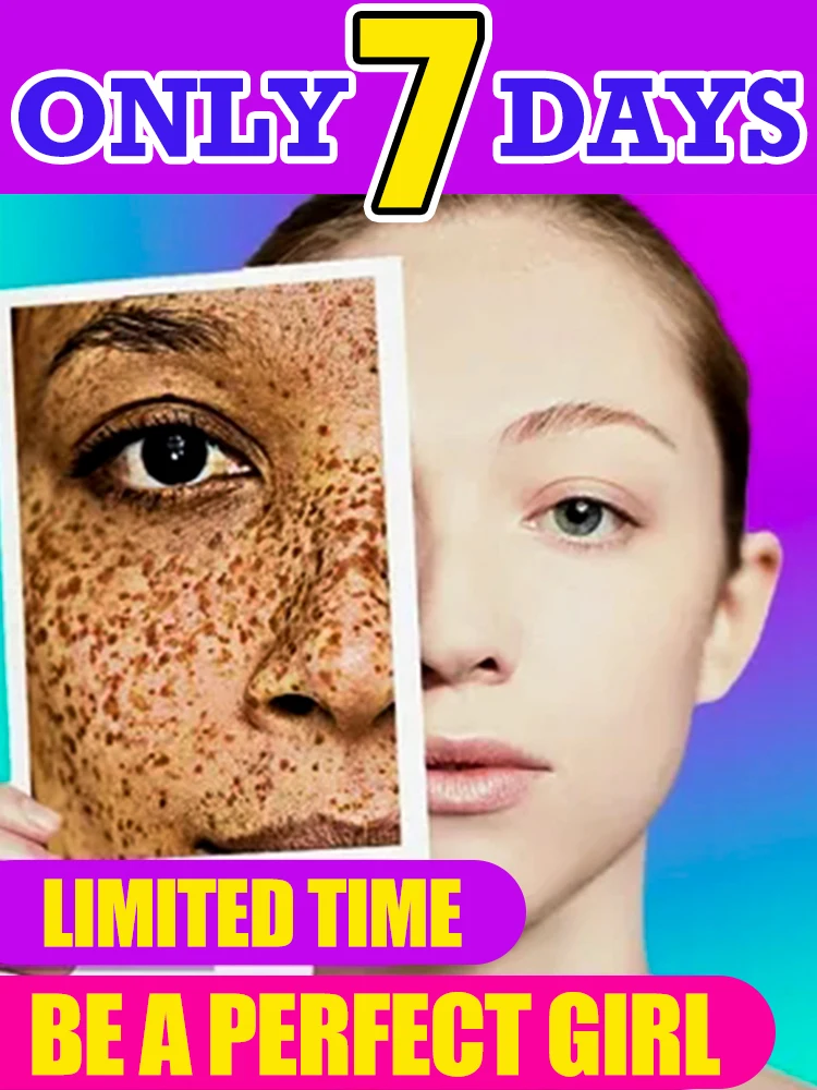 

Reduces Pigment Marks & Brightens Complexion