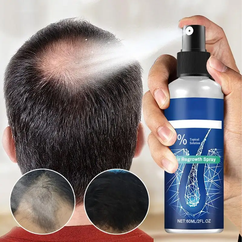 Hair Regrowth for Men 60ml Hair Growth Essence Hair Growth Oil Portable Hair Growth Supplements Scalp Care Hair Growth Spray