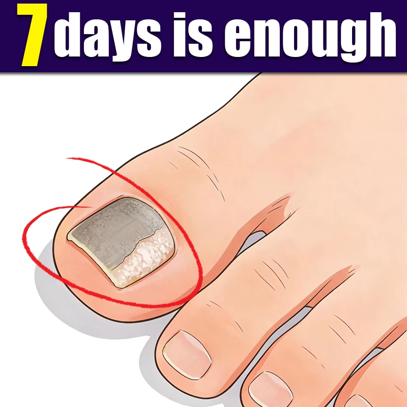 

Using nail cleaning and care tools to ensure a healthy lifestyle