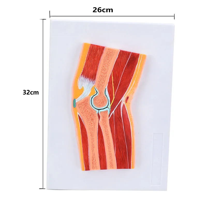 Human Elbow Joint Skeleton Muscle Cross Section Anatomy Model Biology Science Teaching Resources Dropshipping