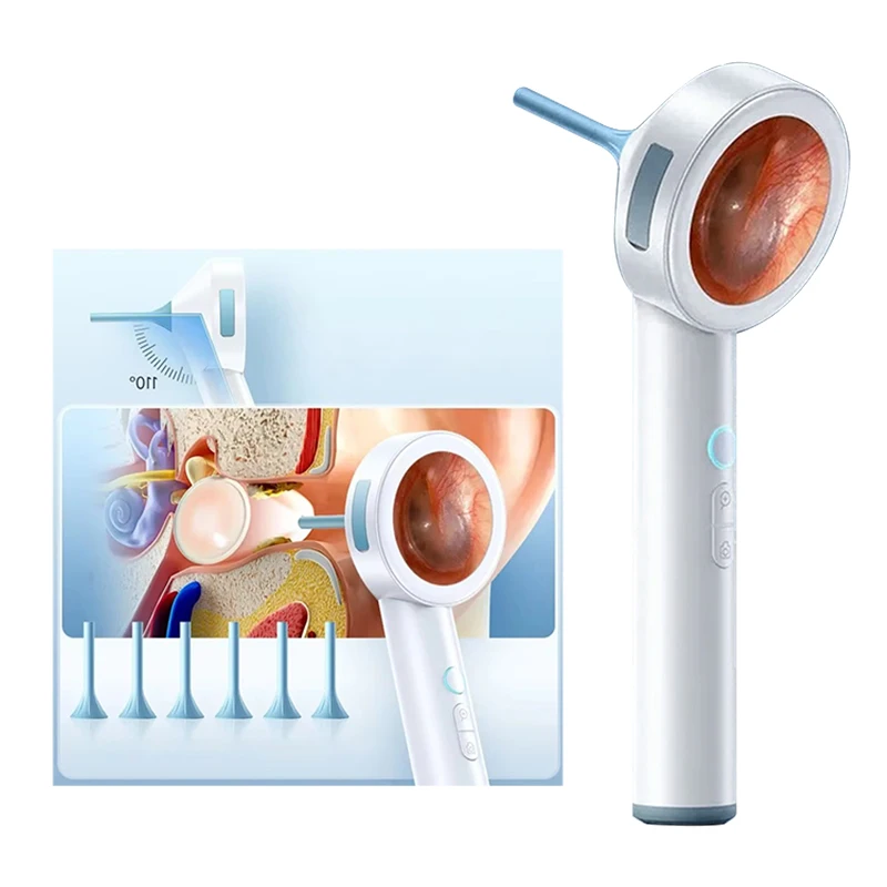 

HD 1080P Ear Nose Visual Smart Endoscope 1.8'' Camera Scope Wireless Portable Otoscope Cleaner with Specula Cone for Adult Child