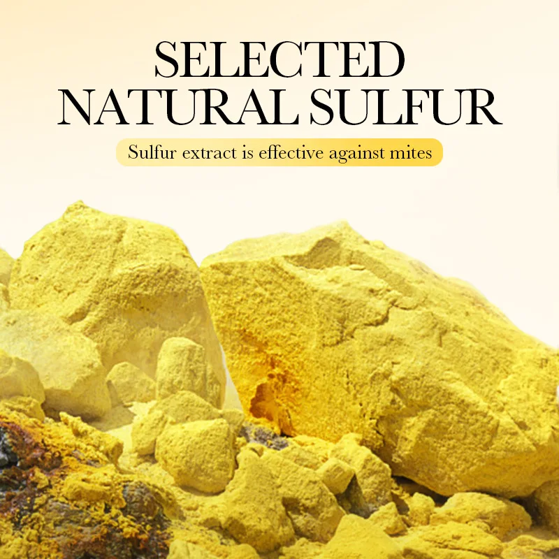 Sulfur Soap Gently Cleanses And Removes Dirt Providing Deep Cleaning Nurturing Care For The Skin, Leaving It Smooth And Delicate