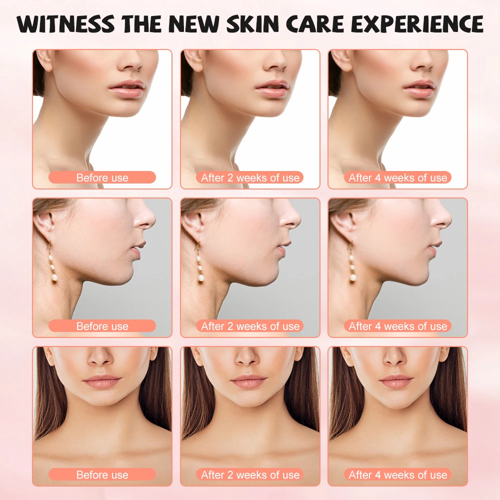 フェイスリフトデバイス,マイクロカレント振動マッサージャー,v字型,ledフォトンセラピー,ダブルチンリムーバー,フェイスリミング