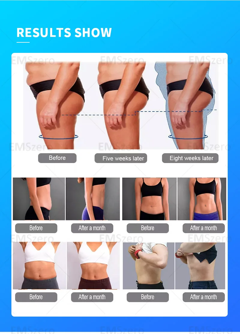 EMSZERO أفضل 15 تسلا 200 هرتز فقدان الوزن وممارسة تشكيل الجسم الكهرومغناطيسي HI-EMT آلة التخسيس