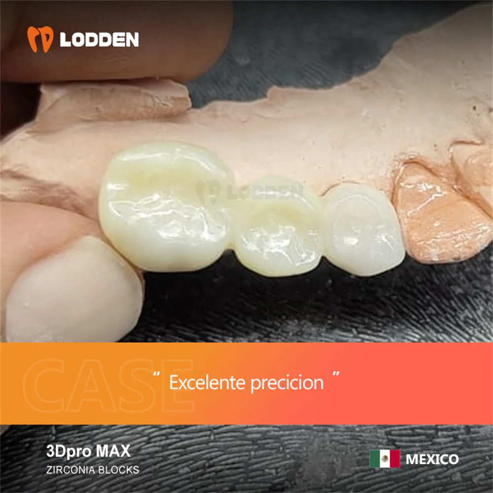 LODDEN Dental Lab 3D Pro Max Zirconia 98*16mm 5 Layers Multilayer Blocks Zirconia Disc Denture Materials Transparency 43%-51%