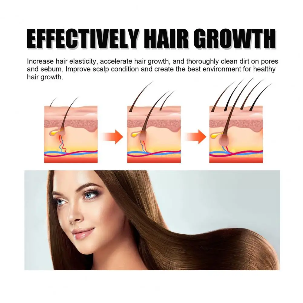 Hair Strengthening Shampoo  Effective Mild Formula Gentle  Prevents Hair Loss Hair Growth Shampoo for Unisex