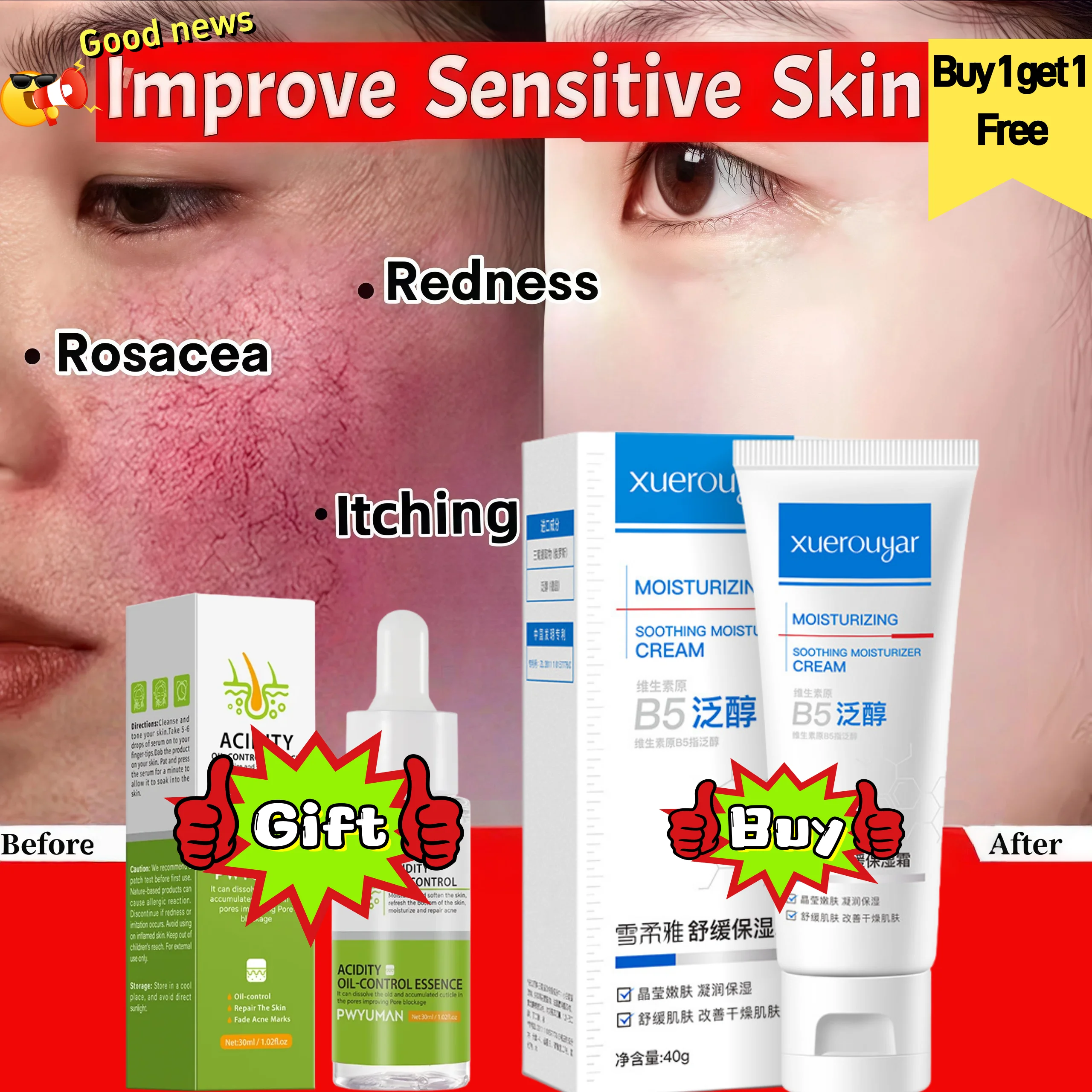 

Repair Facial Redness Cream Instant Spider Vein Remove Sensitive Skin Sooth Anti Redness Rosacea Treat Lotion Korean Cosmetics