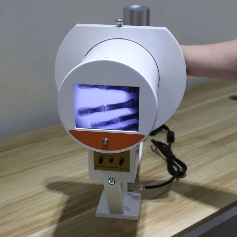 Portable X-ray machine, medical digital mini C-arm X-ray machine (for hospitals)