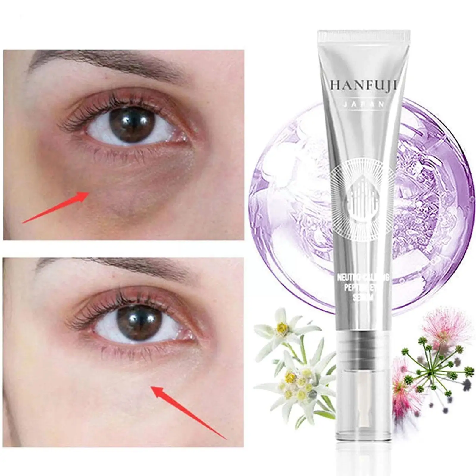 Creme anti-inchado para os olhos, 15g, anti-olheiras, endurecimento escuro, anti-inchado, 15g, atacado