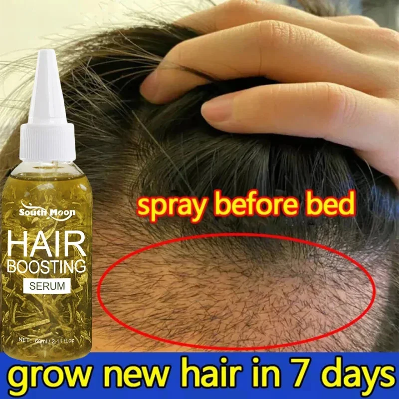 

Масло для быстрого роста волос Africa Crazy Traction Alopecia Сыворотка против разрыва волос, утепленный спрей для лечения выпадения волос для мужчин и женщин