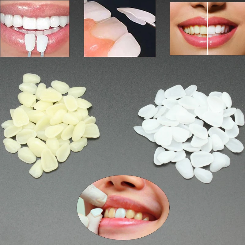 50pcs Dental Teeth Veneers Ultra Thin Whitening Resin Temporary Crown Porcelain Dental Material For Oral Care