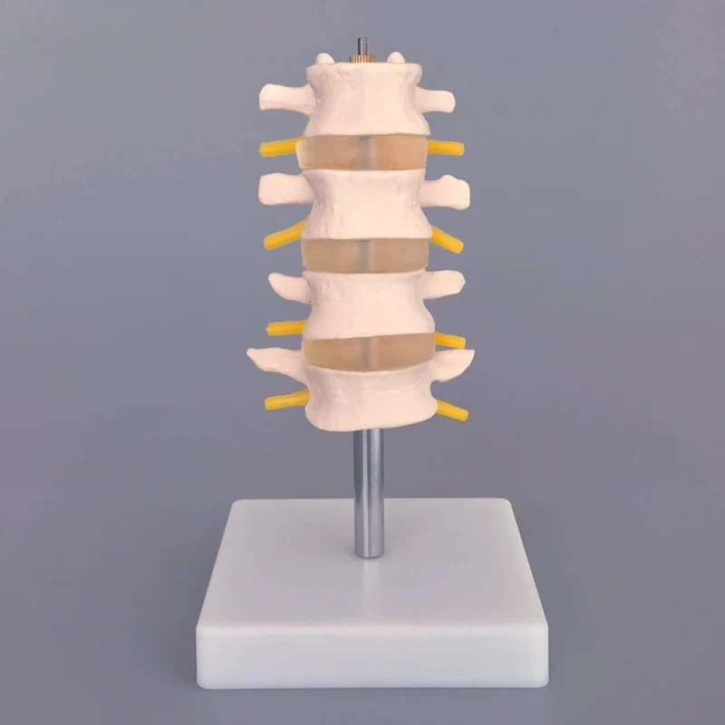 4-Segment Human Lumbar Spine Model with Intervertebral Discs and Nerves Orthopedic Anatomical Teaching Aid