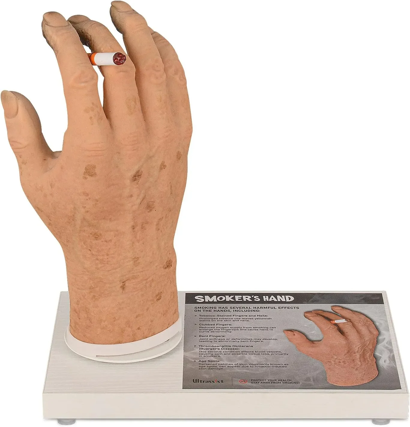 Ultrassist Smoking Hand Model Exposure Phenotype Pathology Display Rotating Magnetic Tray for Medical Education Health Teaching