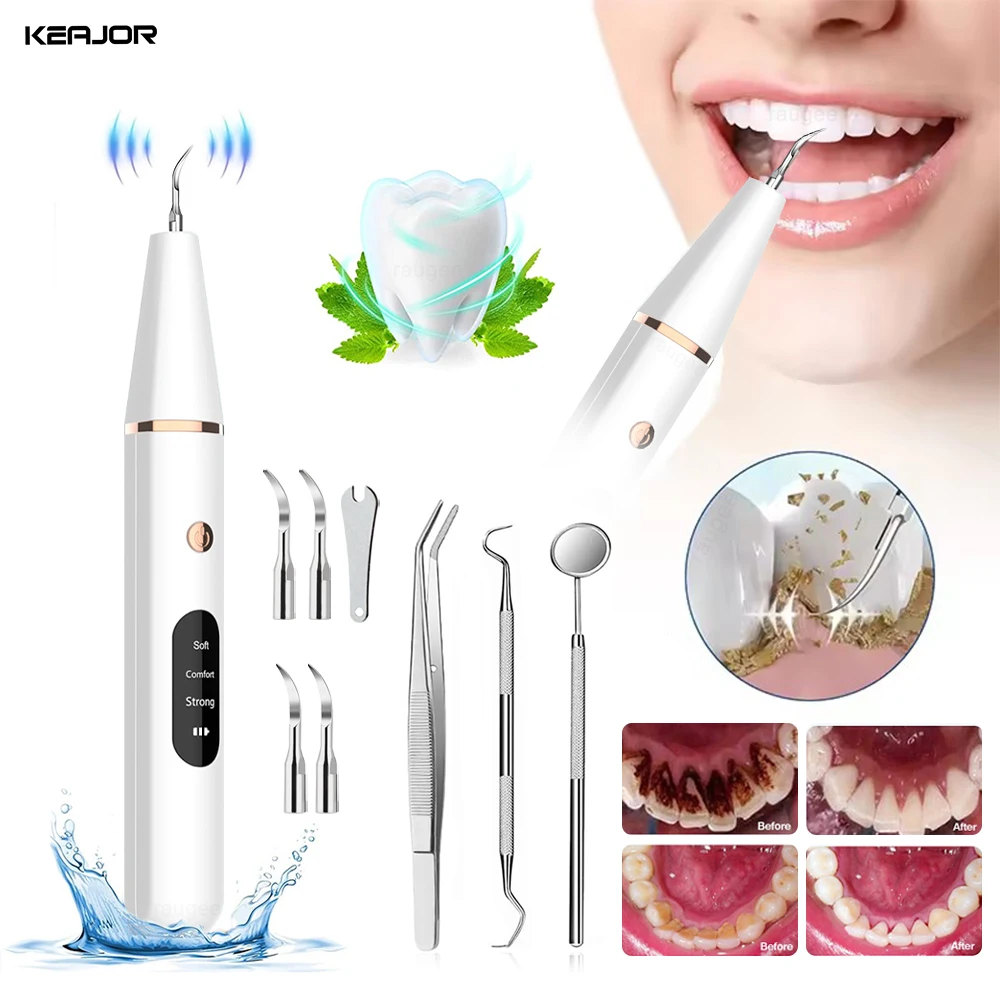 

Ultrasonic Dental Calculus Remover Tartar Eliminator Teeth Cleaning Scaler Ultrasound Tooth Plaque Cleaner Stone Stains Removal