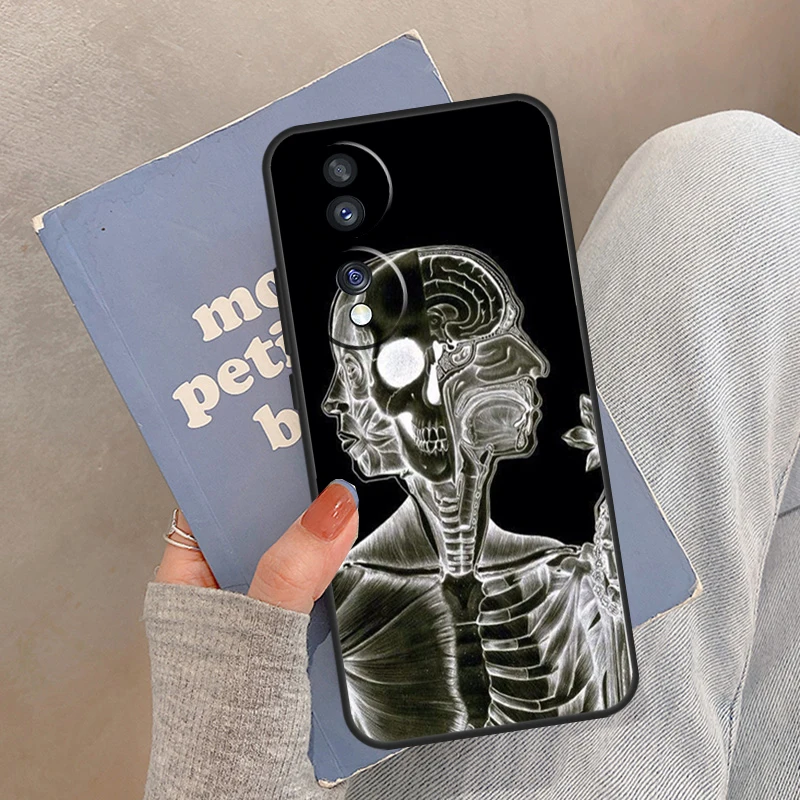 حافظة تشريح الهيكل العظمي الطبي لهاتف Honor Magic 8 7 6 5 Pro Cover For Honor 400 200 X9c X9b X9a X8a X8b 50 70 90 Lite