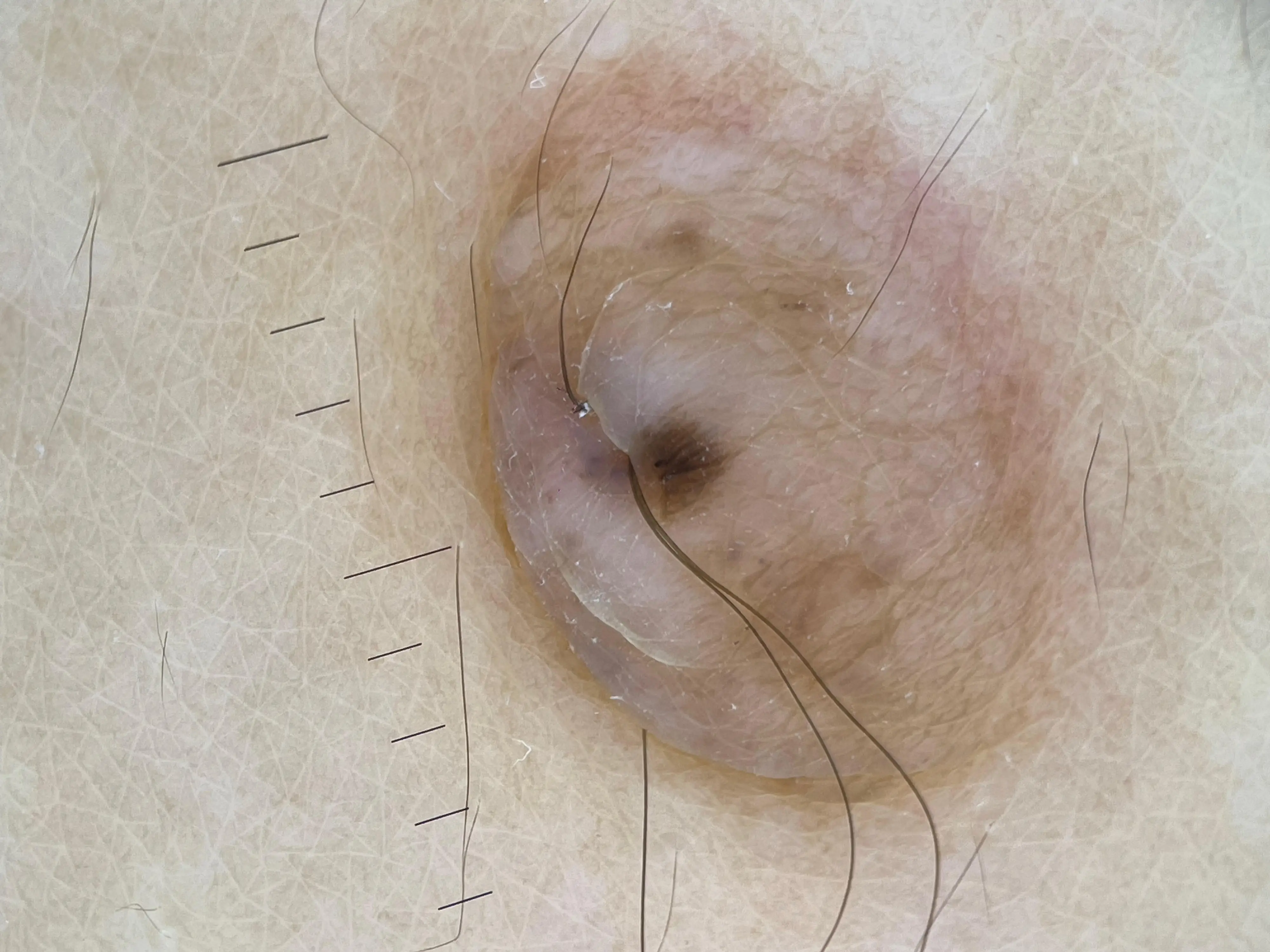 

IBOOLO перезаряжаемый поставщик дерматоскопов со светодиодной подсветкой DE500 умный гаджет для меланомы