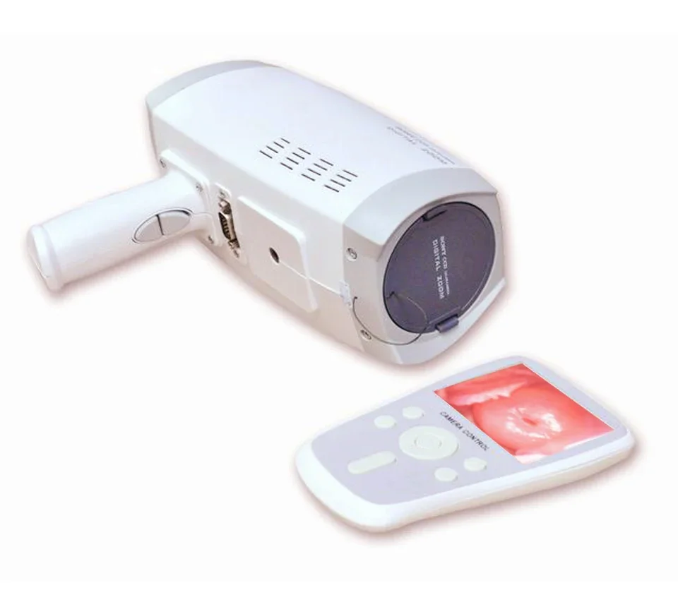 

Greatest gynecology products Laptop Colposcope/digital video colposcope/ colposcope