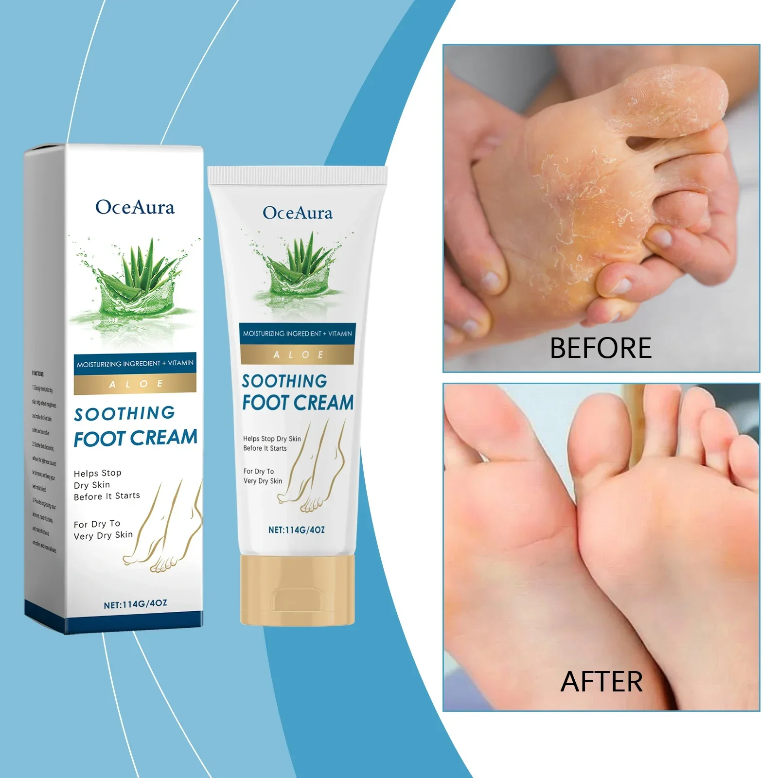 كريم الألوة فيرا لترطيب البشرة بلطف وتحمي كريم العناية بالقدم الجافة والخشنة