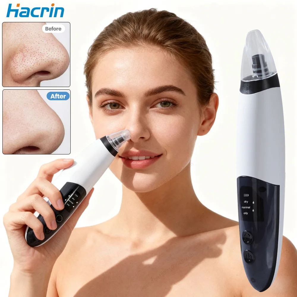Rimozione di punti neri Elettrico Cura della pelle del viso Rimozione dei pori Detergente Aspirapolvere Rimozione dell'acne per pori facciali profondi Rimozione di punti neri