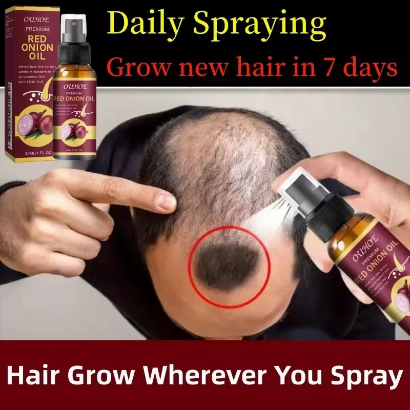 Powerful Hair Growth Spray Anti Hair Loss Serum Products Fast Grow Repair Nourish Roots Regrowth Thicken Hair Care For Men Women