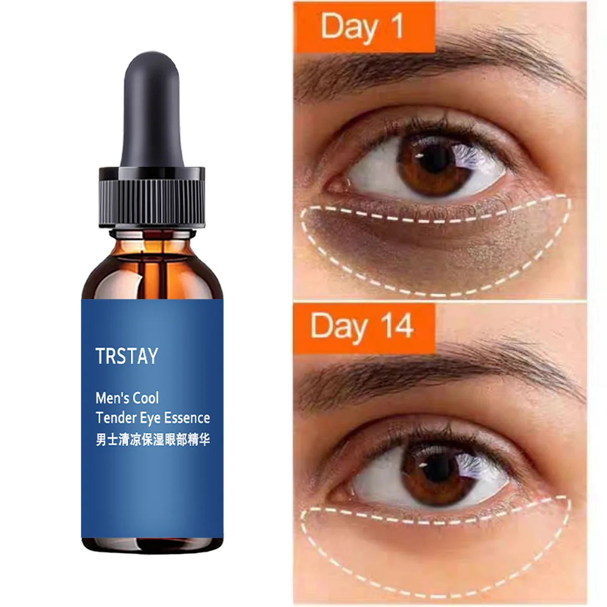 

TRSTAY Прохладная увлажняющая эссенция для глаз восстанавливает защитный барьер для кожи, уход за кожей беременных и беременных, сыворотка для глаз