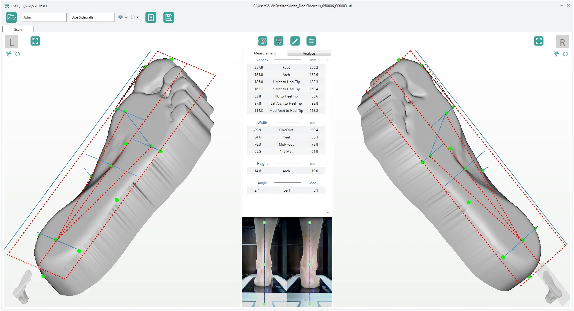 Feet Scan Instrument for Foot Care Insole Intelligent Biological Force Line Detection Testing Equipment Laser 3d Foot Scanner