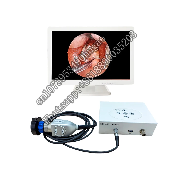 medical  HD USB portable ent  and urology cystoscopy hysteroscopic surgery system