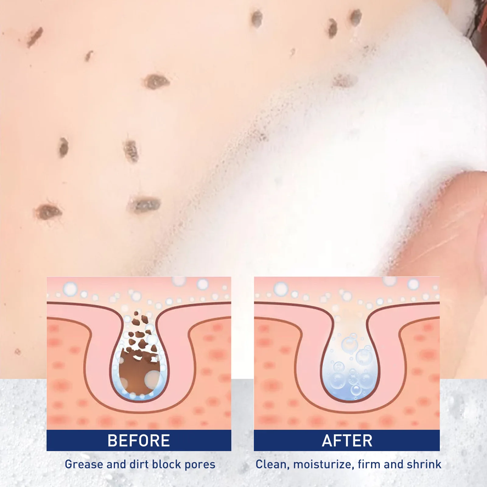 60Ml Exfoliating Mousse, Cleansing Skin Pore Oil Control Gently Cleansing Exfoliating Blackheads Dead Skin