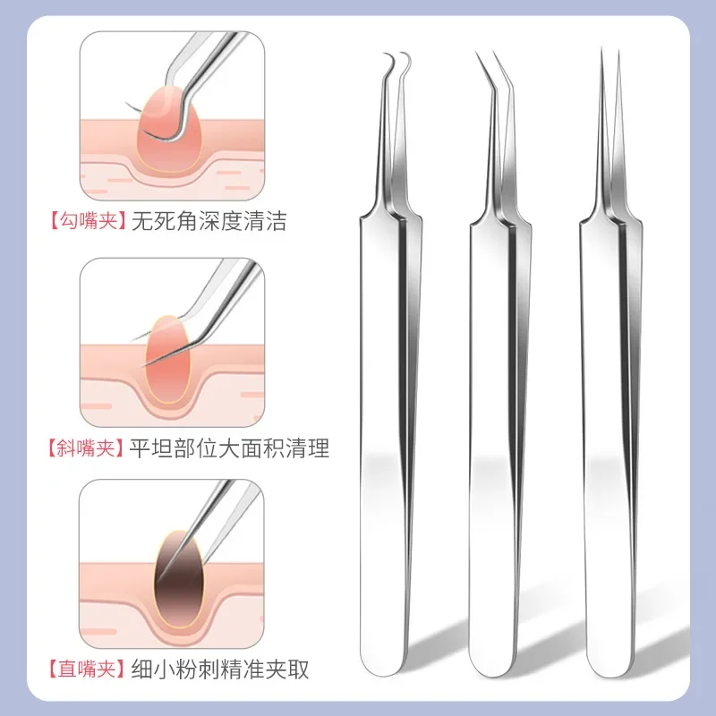 4pcs Professional Tweezers Acne Remover German Ultra-fine No. 5 Cell Pimples Blackhead Clip Facial Pore Cleaning Care Tool