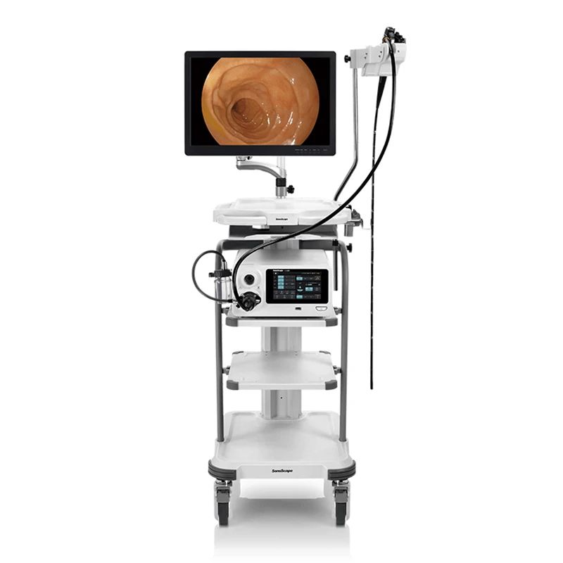 2026 New Sonoscape X-2600 Electronic Endoscope Endoscope Camera . Endoscope Camera