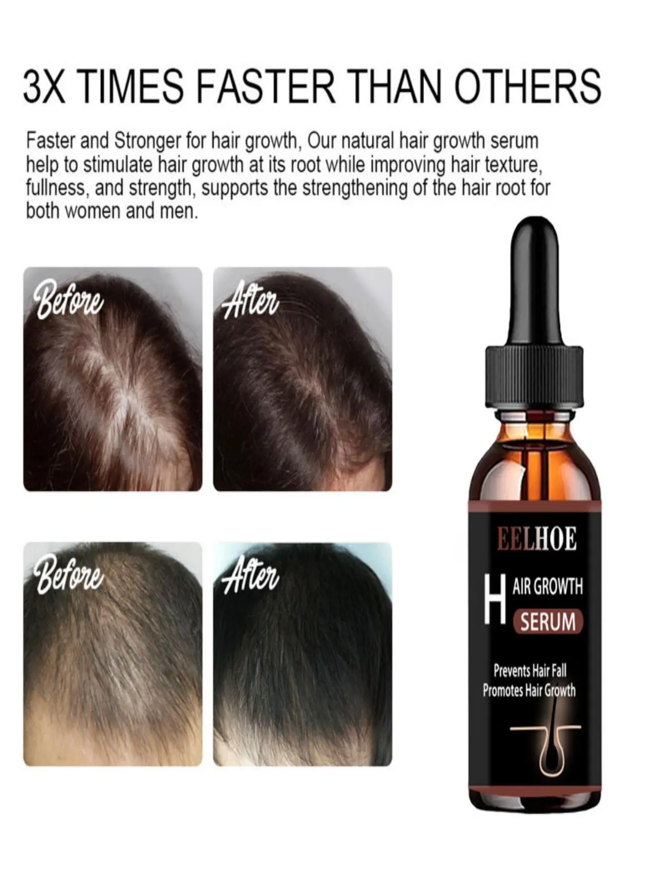 Fast Hair Growth Ginger Oil Natural Plant Essence Faster Grow Hair Tonic Growing Shampoo No Hair Loss Hair Care Beauty Tools