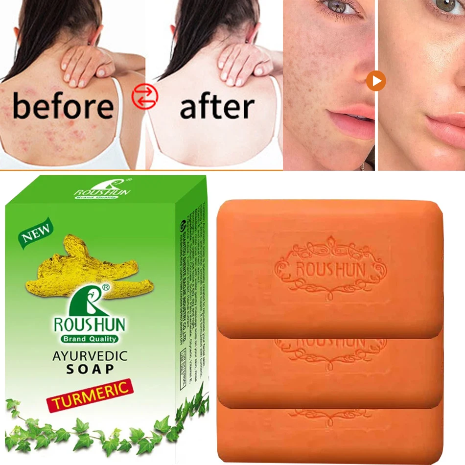 

3Pcs Turmeric Handmade Soap Face Cleansing Anti Acne Whitening Skin Lightening Face Remove Pimples Dark Spots Lightening Soap