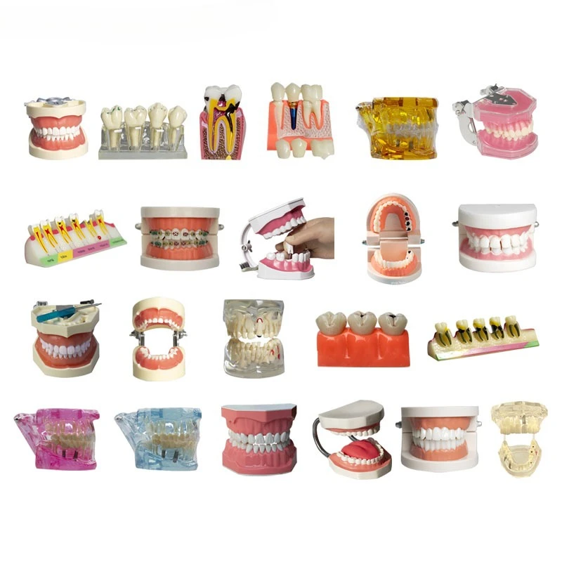 modelos de enseñanza Dental, estudio, ortodoncia, dientes extraíbles, modelos implante,educación del paciente Material dentista