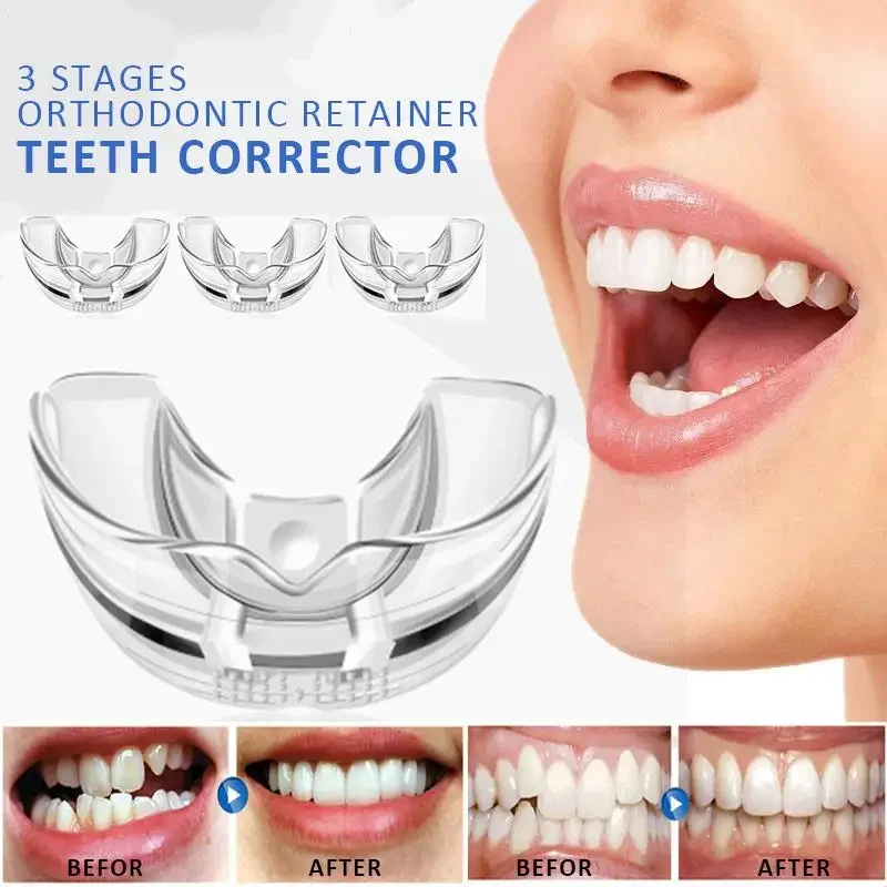 

3 Stages Orthodontic Retainer Teeth Corrector Dental Straighten Braces Trainer