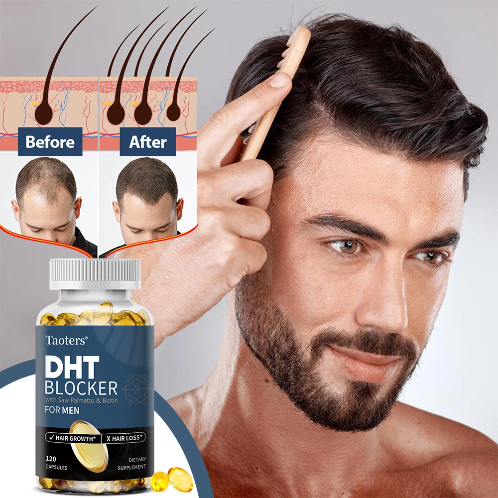 DHT Blockers for Men - with Saw Palmetto & Biotin,Promote Natural Hair Growth, Increase Vitality, and Maximize Absorption